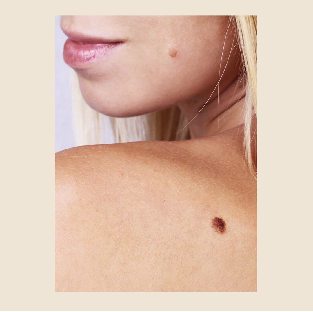Ana Gutiérrez- Estética Avanzada - Imagen 3